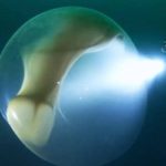 O que seria essa enorme esfera gelatinosa encontrada por mergulhadores?