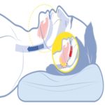 Sarcopenia seria uma das causas por trás da apneia do sono