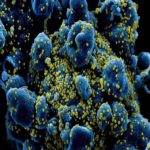 Imagens mostram células humanas sob ataque do coronavírus