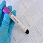 Testes pelo mundo buscam cura para o novo coronavírus