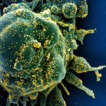 Estudos indicam que células T podem proteger organismo contra Sars-CoV-2